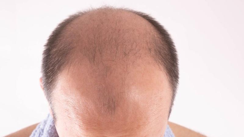 Szampony i odżywki dla mężczyzn